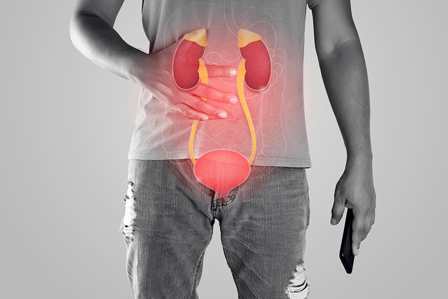 Especialista en cáncer de riñón en Nuevo Vallarta 